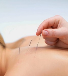 HEALING POWER OF ACUPUNCTURE