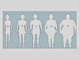 Obesity Scale and BMI